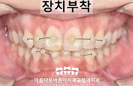 수술후