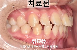 수술전