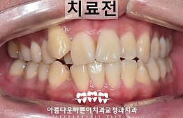 수술전