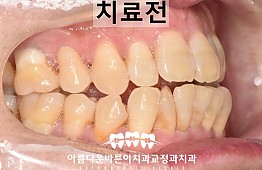 수술전