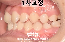 수술후