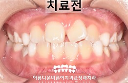 수술전