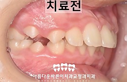 수술전