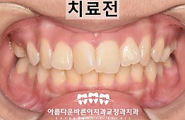 수술전