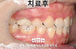 수술후