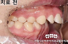 수술전