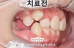 수술전