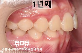 수술후