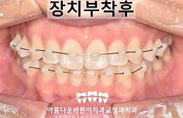 수술후