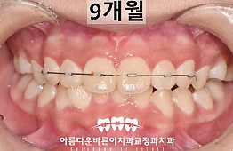 수술후