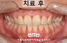 수술후