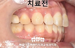 수술전