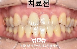 수술전