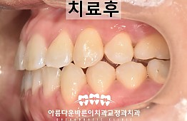 수술후