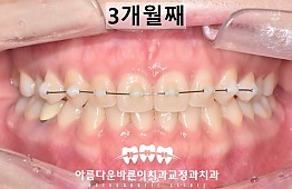 수술후