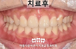 수술후