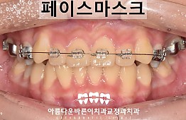 수술후