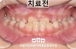 수술전