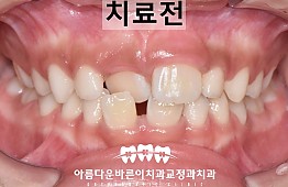 수술전