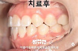 수술후