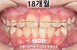 수술후