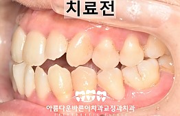 수술전