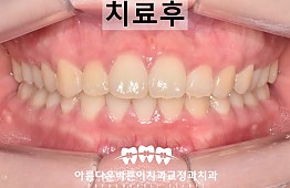 수술후