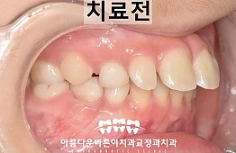 수술전