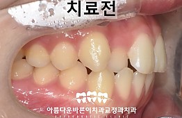 수술전