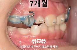 수술후