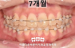 수술후