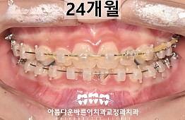 수술후