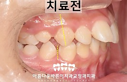 수술전