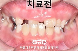 수술전