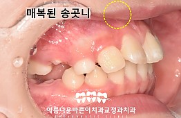 수술전