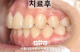 수술후