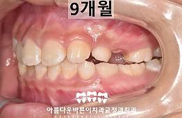 수술후