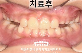 수술후