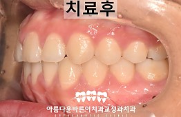 수술후