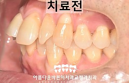 수술전