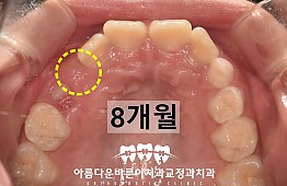 수술후