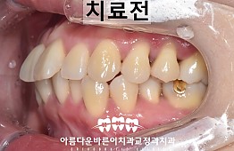 수술전