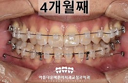 수술후