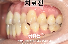 수술전