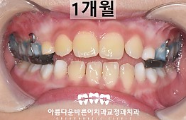 수술후