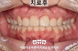 수술후