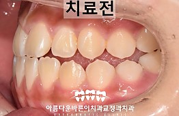 수술전