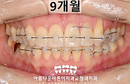 수술후