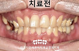 수술전