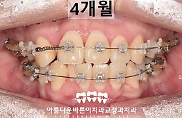 수술후